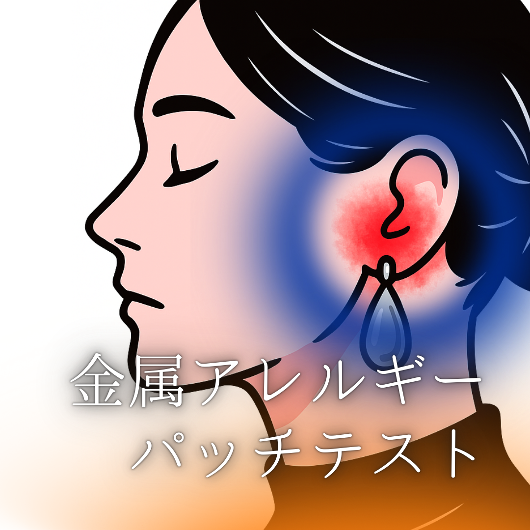 金属アレルギーとパッチテスト｜那覇セントラルクリニック
