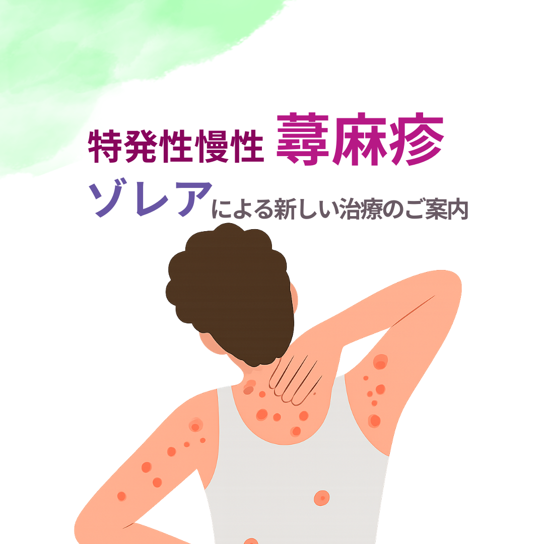 特発性慢性蕁麻疹（じんましん）の新しい治療｜ゾレアのご相談なら那覇セントラルクリニック